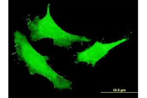 Immunofluorescence of purified MaxPab antibody to NUSAP1 on HeLa cell.