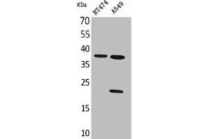 Western Blot analysis of BT474 A549 cells using IFN-α1 Polyclonal Antibody (IFNA1 anticorps  (C-Term))