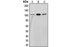 Western blot analysis of SND1 expression in HepG2 (A), Jurkat (B), Ramos (C) whole cell lysates.