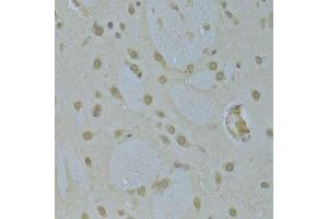 Immunohistochemistry of paraffin-embedded rat brain using HNRNPK Antibody.