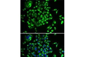 Immunofluorescence analysis of U2OS cells using MRPL28 Polyclonal Antibody (MRPL28 anticorps)