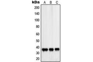 Western blot analysis of PDLIM1 expression in HeLa (A), Saos2 (B), NIH3T3 (C) whole cell lysates.