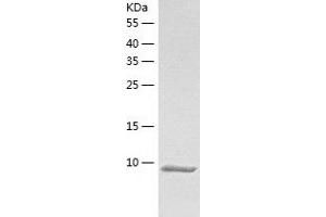 Western Blotting (WB) image for Calcium/calmodulin-Dependent Protein Kinase II Inhibitor 1 (CAMK2N1) (AA 1-78) protein (His-IF2DI Tag) (ABIN7122094)