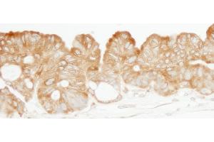 Immunohistochemistry (IHC) image for anti-Lysyl-tRNA Synthetase (KARS) (C-Term) antibody (ABIN7455081)