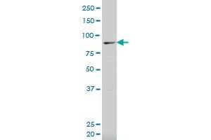 ALOX12B polyclonal antibody (A01), Lot # 051130JC01 Western Blot analysis of ALOX12B expression in Jurkat .