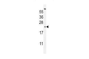 GAGE13 Antibody (N-term) (ABIN654525 and ABIN2844247) western blot analysis in K562 cell line lysates (35 μg/lane). (G Antigen 13 anticorps  (N-Term))