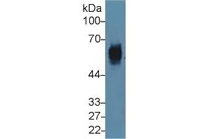 Detection of CK5 in Mouse Skin lysate using Polyclonal Antibody to Cytokeratin 5 (CK5) (Cytokeratin 5 anticorps  (AA 163-471))