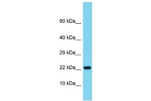 Host: Rabbit Target Name: SAPCD1 Sample Type: Fetal Kidney lysates Antibody Dilution: 1. (SAPCD1 anticorps  (C-Term))