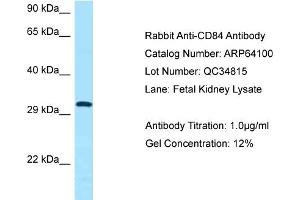 Western Blotting (WB) image for anti-CD84 (CD84) (C-Term) antibody (ABIN2789730) (CD84 anticorps  (C-Term))