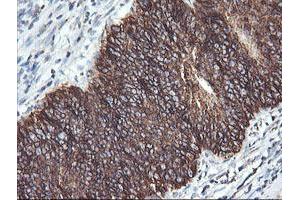 Immunohistochemistry (IHC) image for anti-Acetyl-CoA Acyltransferase 2 (ACAA2) antibody (ABIN1495723)