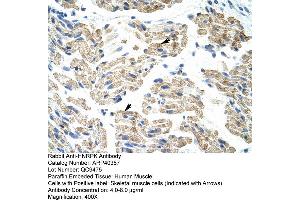 Rabbit Anti-HNRPK Antibody  Paraffin Embedded Tissue: Human Skeletal Muscle Cellular Data: Skeletal muscle  Antibody Concentration: 4. (HNRNPK anticorps  (C-Term))