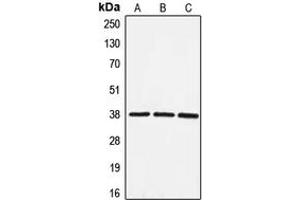 Western blot analysis of EIF3F expression in HeLa (A), HepG2 (B), NIH3T3 (C) whole cell lysates. (EIF3F anticorps  (Center))