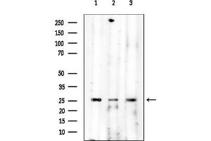 Western blot analysis of lysates from various samples, using AQP2 Mouse Monoclonal Antibody at 1/1000 dilution.