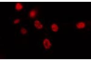 ABIN6274426 staining HepG2 cells by IF/ICC. (SPIC anticorps  (Internal Region))