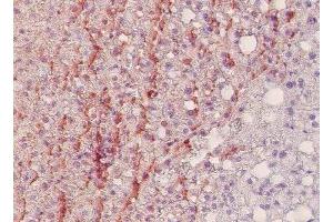 Nitrotyrosine in human liver of severely obesed patients. (Nitrotyrosine anticorps)