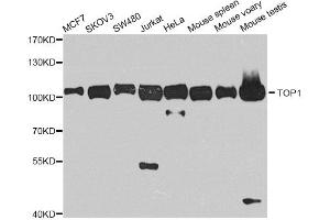 Western blot analysis of extracts of various cell lines, using TOP1 antibody. (Topoisomerase I anticorps)