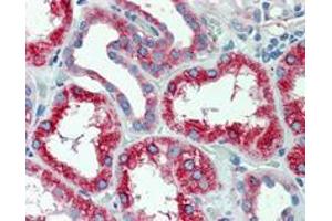 Immunohistochemistry (Formalin/PFA-fixed paraffin-embedded sections) of human kidney with SLC11A2 polyclonal antibody . (SLC11A2 anticorps  (Internal Region))