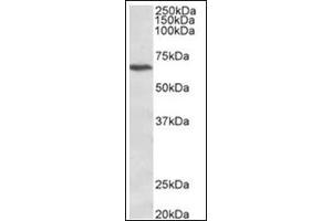 Staining of Jurkat lysate (35µg protein in RIPA buffer) using CACNB2 antibody at 1 µg/ml. (CACNB2 anticorps  (C-Term))