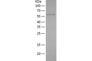 Western Blotting (WB) image for ATP-Binding Cassette, Sub-Family F (GCN20), Member 2 (ABCF2) (AA 1-218) protein (His-IF2DI Tag) (ABIN7121933) (ABCF2 Protein (AA 1-218) (His-IF2DI Tag))