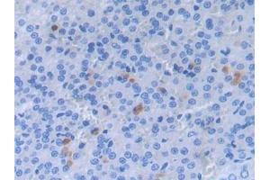 Detection of a2PI in Rat Adrenal gland Tissue using Polyclonal Antibody to Alpha 2-Antiplasmin (a2PI) (a2PI (AA 348-491) anticorps)