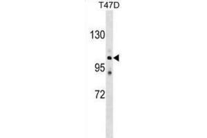 Western Blotting (WB) image for anti-ATPase, Ca++ Transporting, Type 2C, Member 1 (ATP2C1) antibody (ABIN2999252) (ATP2C1 anticorps)
