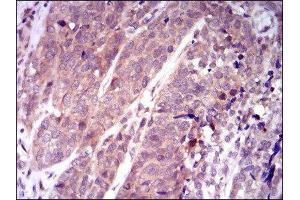 Immunohistochemistry (IHC) image for anti-Kelch-Like ECH-Associated Protein 1 (KEAP1) (AA 380-624) antibody (ABIN1846111)