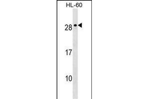 MED18 Antibody (C-term) (ABIN1536799 and ABIN2849776) western blot analysis in HL-60 cell line lysates (35 μg/lane). (MED18 anticorps  (C-Term))
