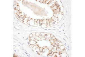 Immunohistochemistry (IHC) image for anti-Junction Plakoglobin (JUP) (AA 695-745) antibody (ABIN7454953) (JUP anticorps  (AA 695-745))