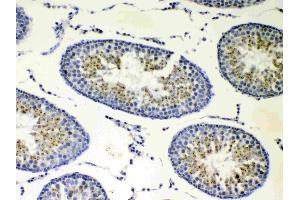 IHC analysis of CP110 using anti-CP110 antibody .