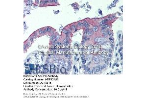 Immunohistochemistry (IHC) image for anti-Abhydrolase Domain Containing 5 (ABHD5) (C-Term) antibody (ABIN2775425)