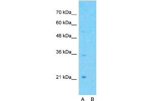 Host:  Rabbit  Target Name:  GPCR5A  Sample Type:  Jurkat  Lane A:  Primary Antibody  Lane B:  Primary Antibody + Blocking Peptide  Primary Antibody Concentration:  1ug/ml  Peptide Concentration:  5ug/ml  Lysate Quantity:  25ug/lane/lane  Gel Concentration:  0. (GPRC5A anticorps  (C-Term))