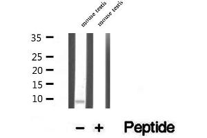 Western blot analysis of extracts of mouse testis tissue, using TNP1 antibody. (TNP1 anticorps  (Internal Region))