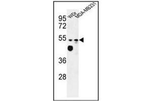 Western blot analysis of Tricellulin Antibody (C-term) in WiDr, MDA-MB231 cell line lysates (35ug/lane). (Tricellulin anticorps  (C-Term))