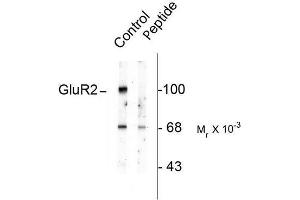 Image no. 1 for anti-Glutamate Receptor, Ionotropic, AMPA 2 (GRIA2) (pSer880) antibody (ABIN372656) (GRIA2 anticorps  (pSer880))
