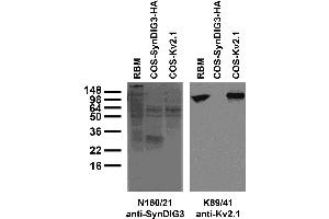 anti-Transmembrane Protein 91 (TMEM91) (AA 1-96), (Cytosolic), (N-Term) antibody