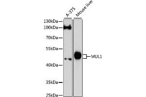 Western blot analysis of extracts of various cell lines, using MUL1 antibody (ABIN6133239, ABIN6144199, ABIN6144200 and ABIN6217001) at 1:3000 dilution. (MUL1 anticorps  (AA 1-352))