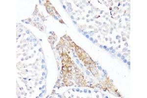 Immunohistochemistry of paraffin-embedded Mouse testis leydig using Fibronectin Polyclonal Antibody at dilution of 1:100 (40x lens). (Fibronectin anticorps)