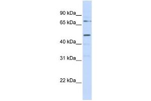 Western Blotting (WB) image for anti-Kringle Containing Transmembrane Protein 1 (KREMEN1) antibody (ABIN2458904)