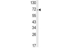 Western blot analysis of ATF6 antibody and A2058 lysate