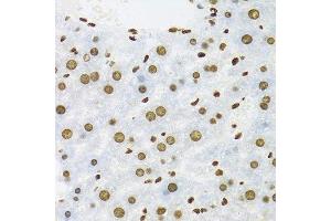 Immunohistochemistry of paraffin-embedded mouse liver using KHDRBS1 antibody.