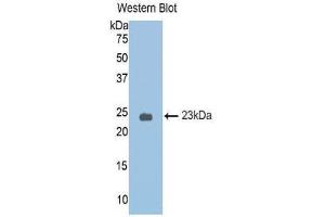 Western Blotting (WB) image for anti-serpin Peptidase Inhibitor, Clade A (Alpha-1 Antiproteinase, Antitrypsin), Member 6 (SERPINA6) (AA 25-195) antibody (ABIN1174369)