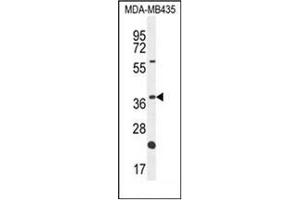 Western blot analysis of OR6V1 Antibody (C-term) in MDA-MB435 cell line lysates (35ug/lane). (OR6V1 anticorps  (C-Term))