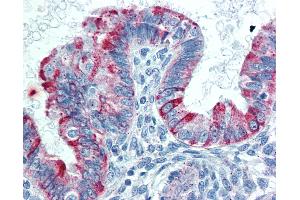 Anti-TNFRSF14 / CD270 antibody IHC of human uterus. (HVEM anticorps  (AA 38-284))
