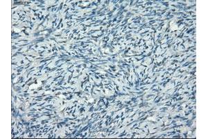 Immunohistochemistry (IHC) image for anti-Protein Phosphatase 5, Catalytic Subunit (PPP5C) antibody (ABIN1500393)