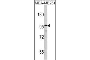 Western blot analysis of DLGAP1 Antibody in MDA-MB231 cell line lysates (35ug/lane) (DLGAP1 anticorps  (N-Term))