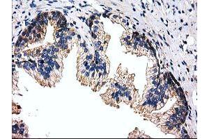 Immunohistochemistry (IHC) image for anti-Striatin Interacting Protein 1 (STRIP1) antibody (ABIN1498205) (STRIP1 anticorps)