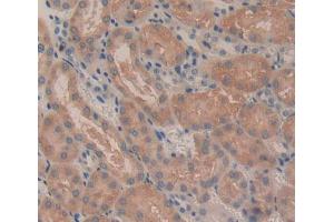 Used in DAB staining on fromalin fixed paraffin- embedded Kidney tissue (CROT anticorps  (AA 410-612))