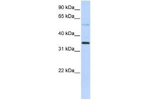 WB Suggested Anti-ANKRD9 Antibody Titration: 0. (ANKRD9 anticorps  (Middle Region))