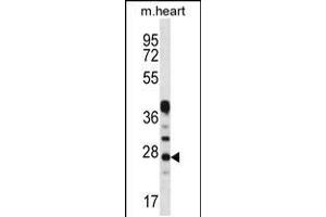 Western blot analysis in mouse heart tissue lysates (35ug/lane). (CRYBA1 anticorps  (AA 104-133))
