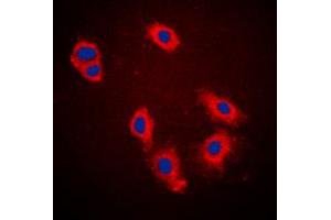 Immunofluorescent analysis of Cytokeratin 18 (pS33) staining in A431 cells.